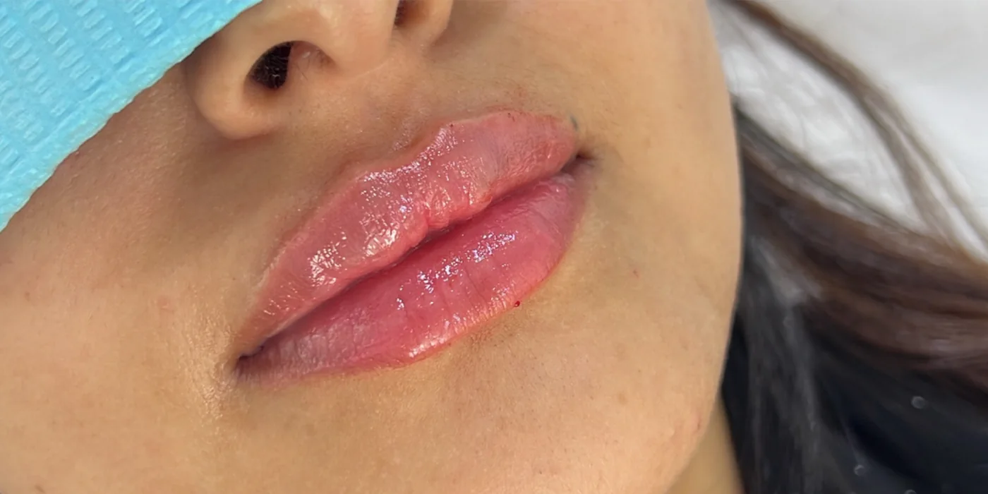 After treatment, result 1 of 16