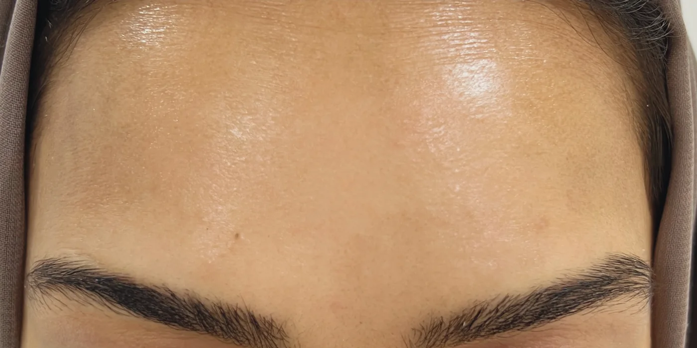After treatment, result 2 of 16