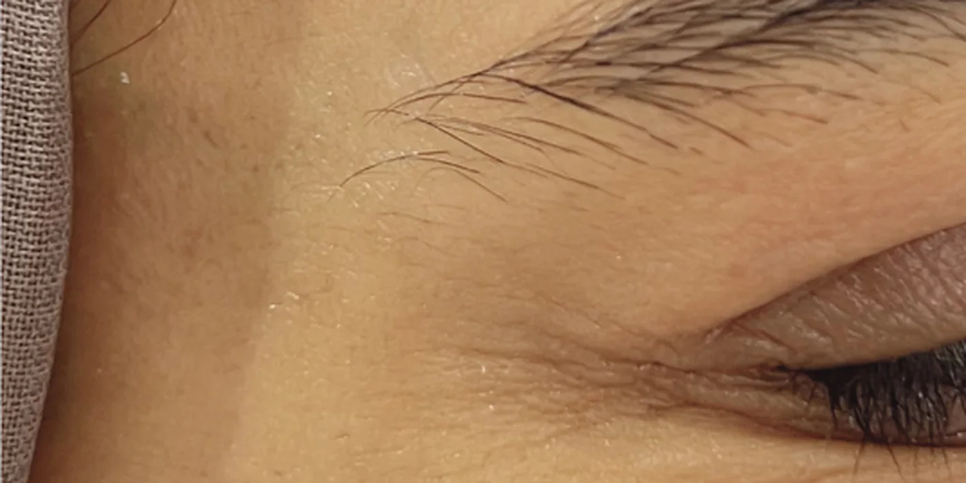 After treatment, result 3 of 16