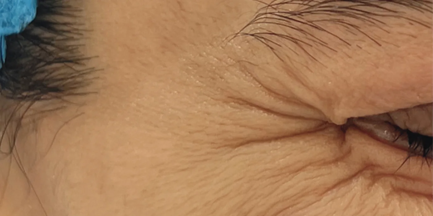 Before treatment, result 3 of 16