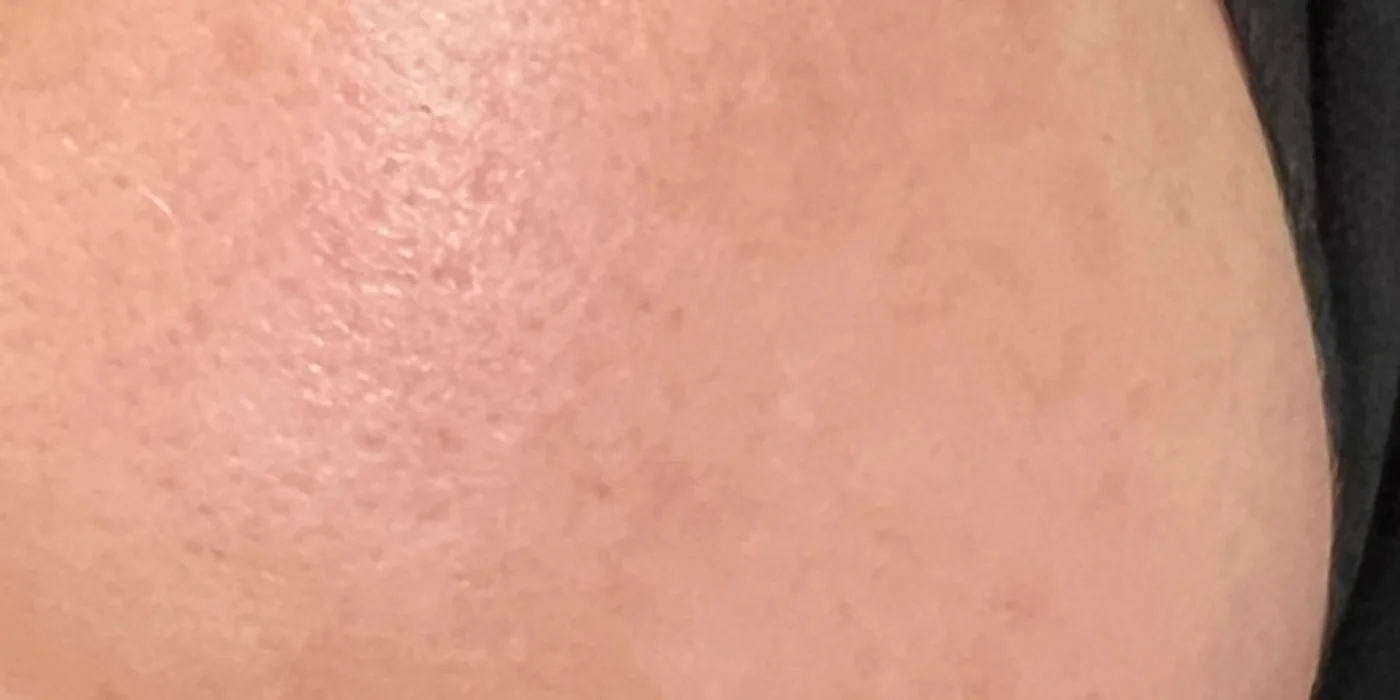 After treatment, result 4 of 16