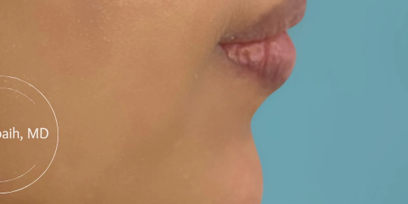 After treatment, result 5 of 16