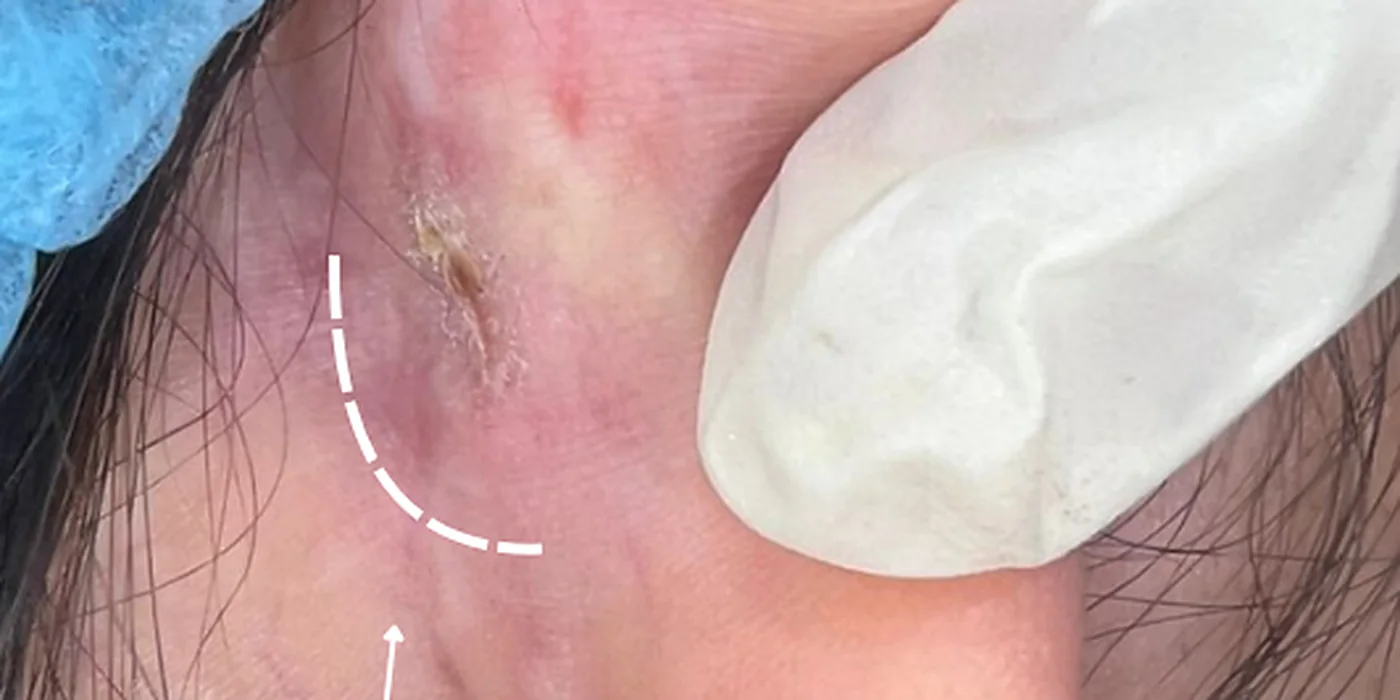 After treatment, result 7 of 16