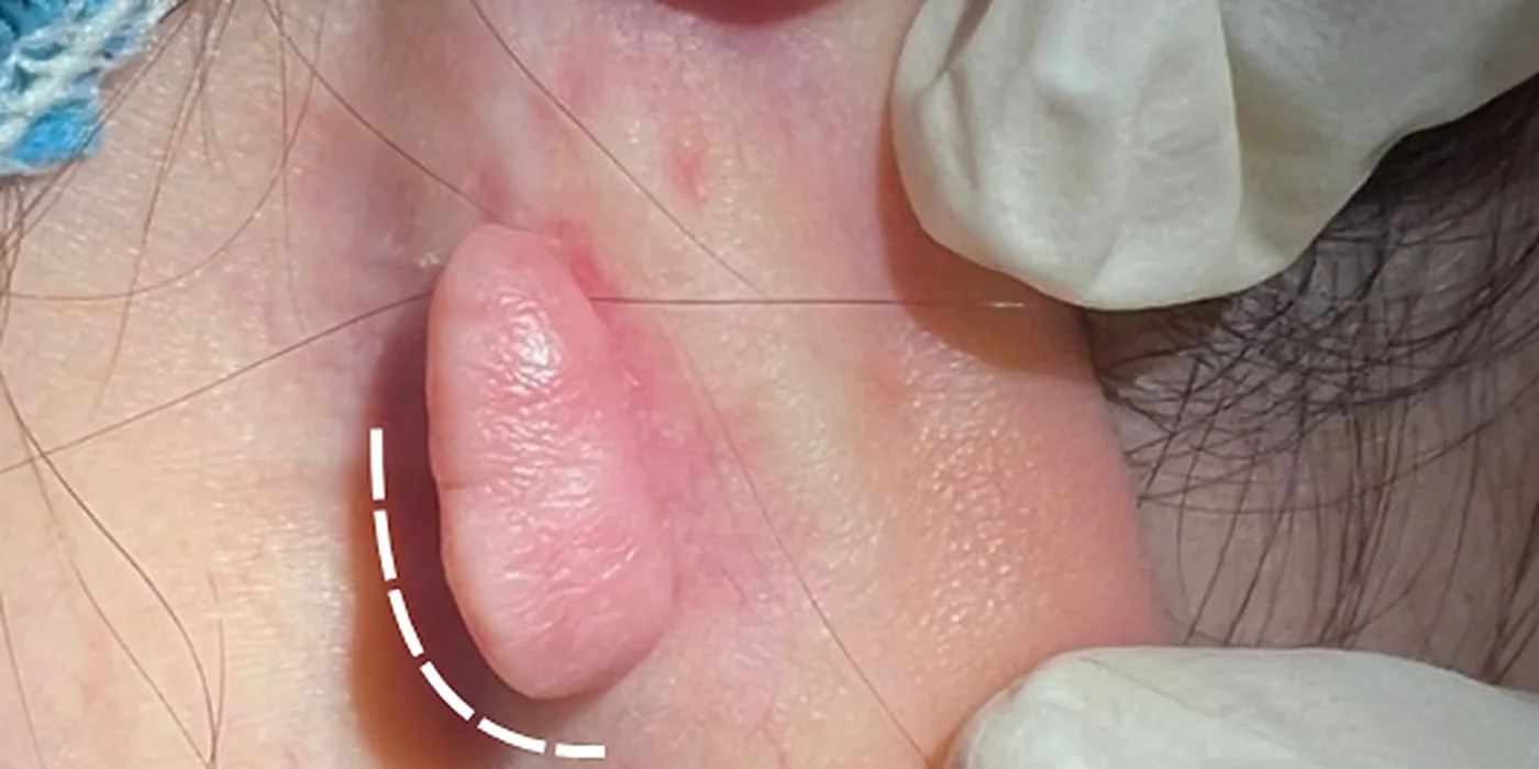 Before treatment, result 7 of 16
