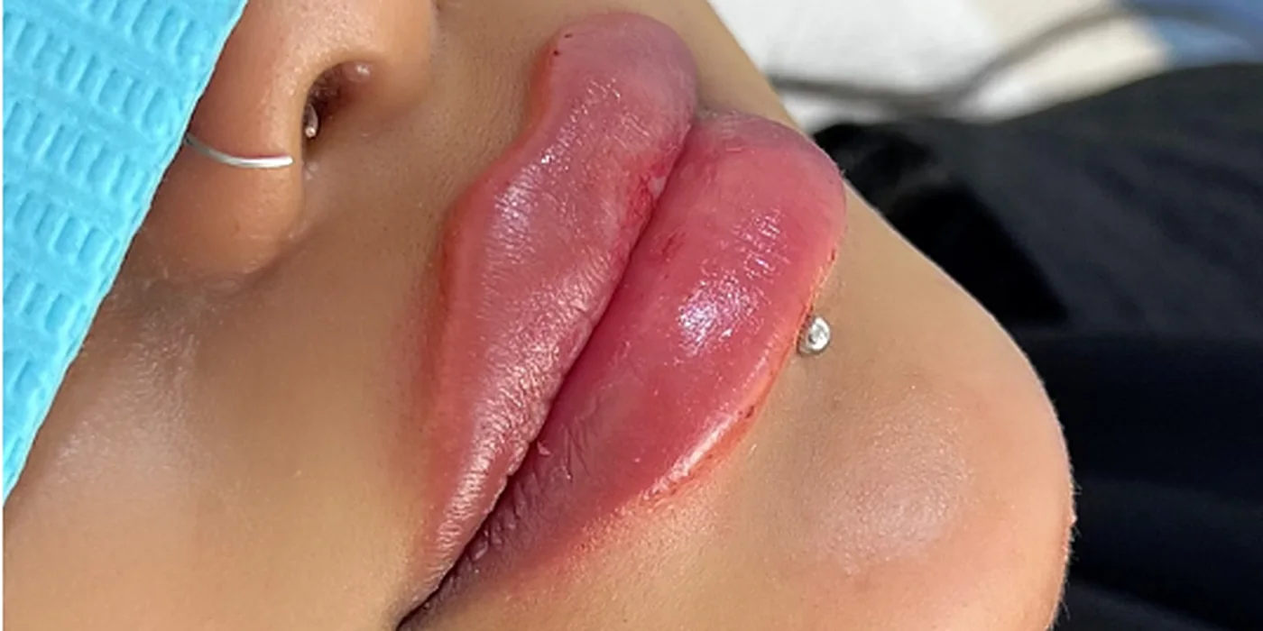 After treatment, result 8 of 16