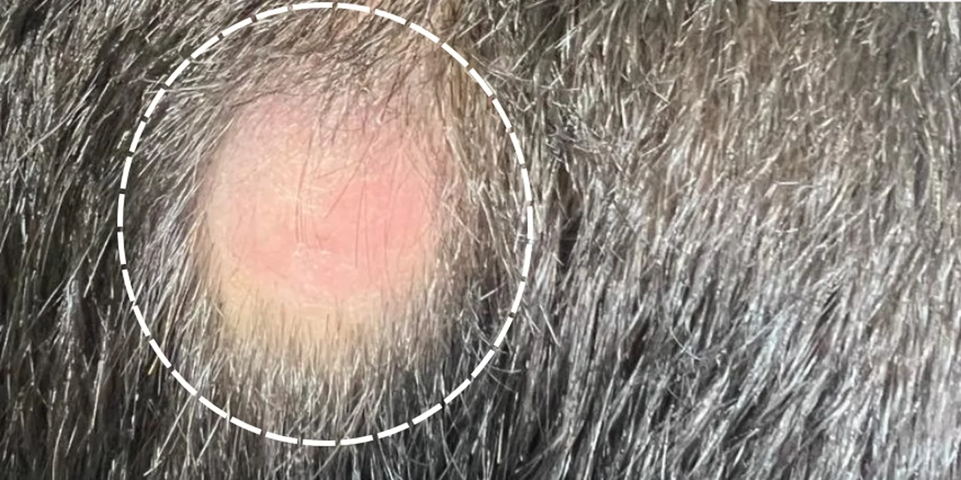 Before treatment, result 11 of 16