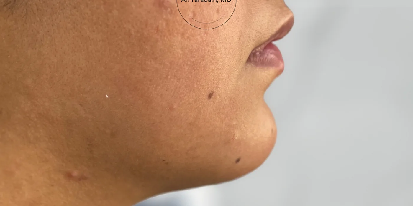 After treatment, result 12 of 16