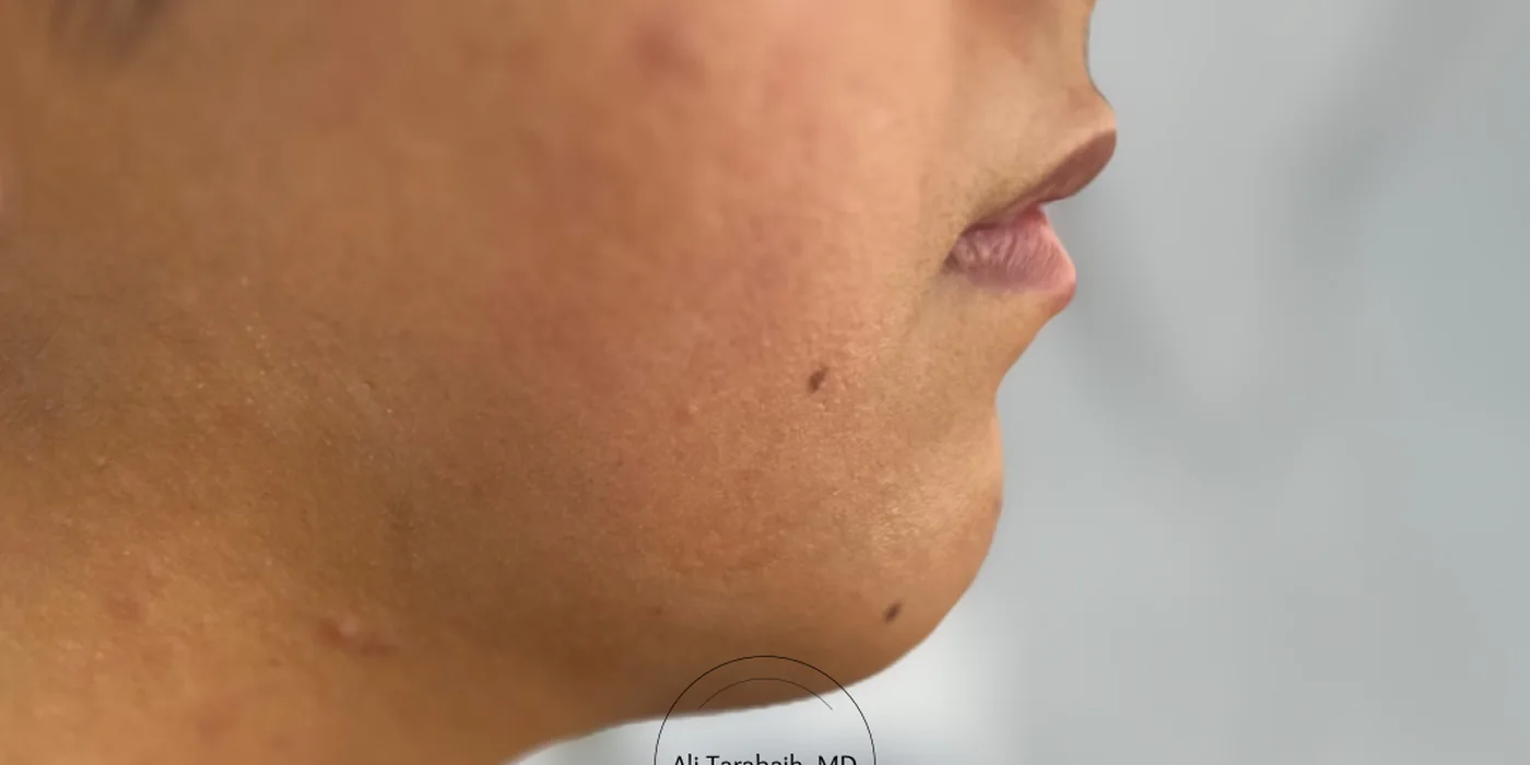 Before treatment, result 12 of 16