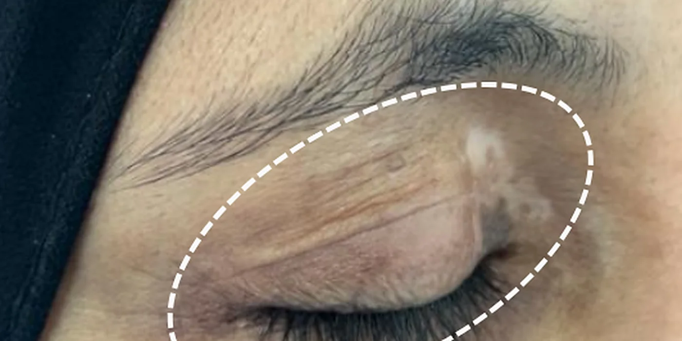 After treatment, result 13 of 16