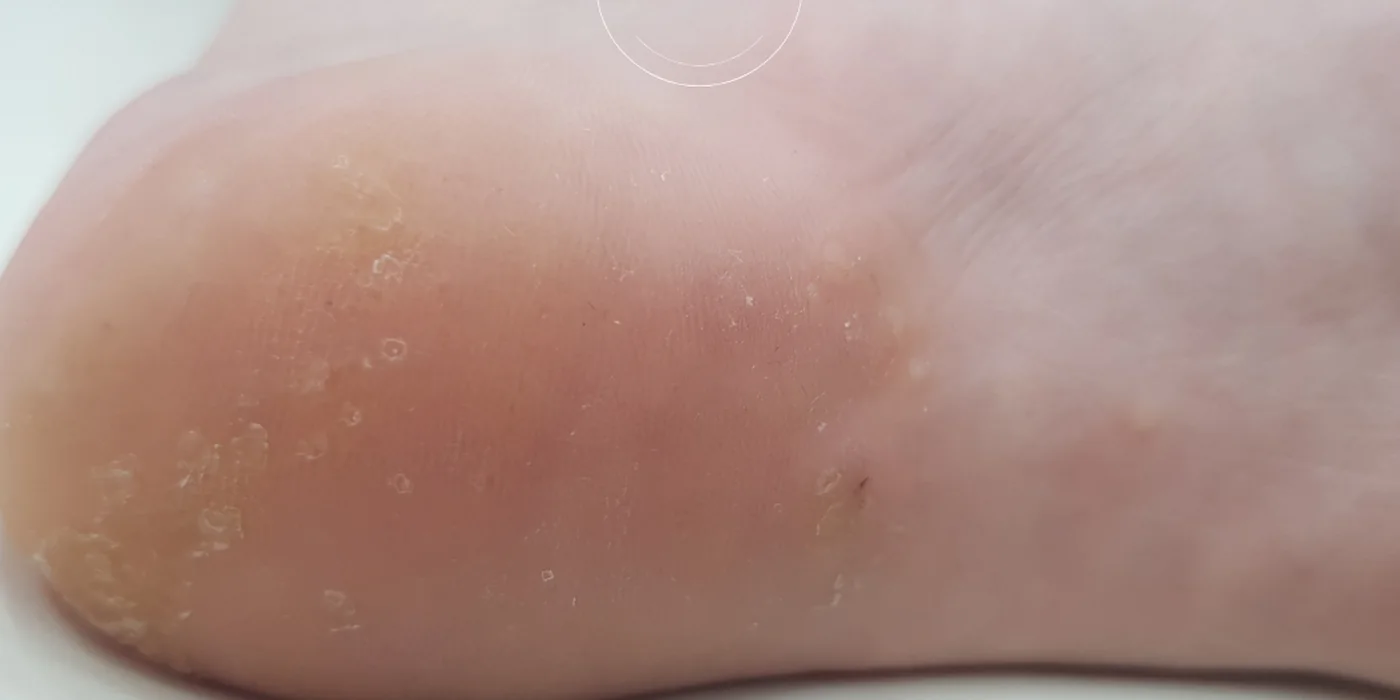 After treatment, result 14 of 16