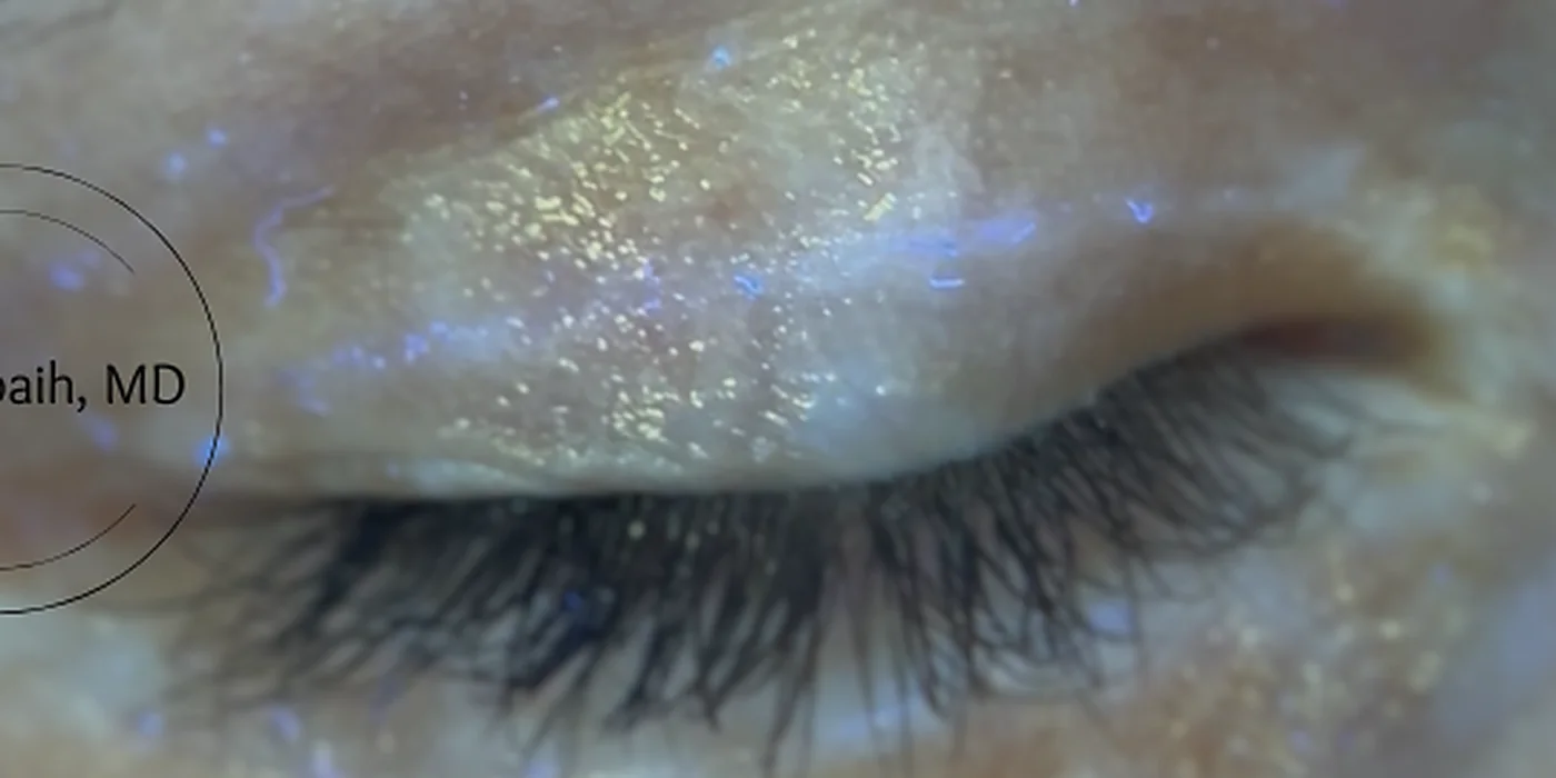 After treatment, result 15 of 16