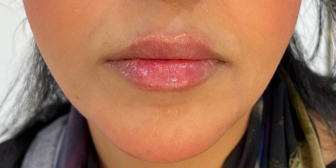 After treatment, result 16 of 16
