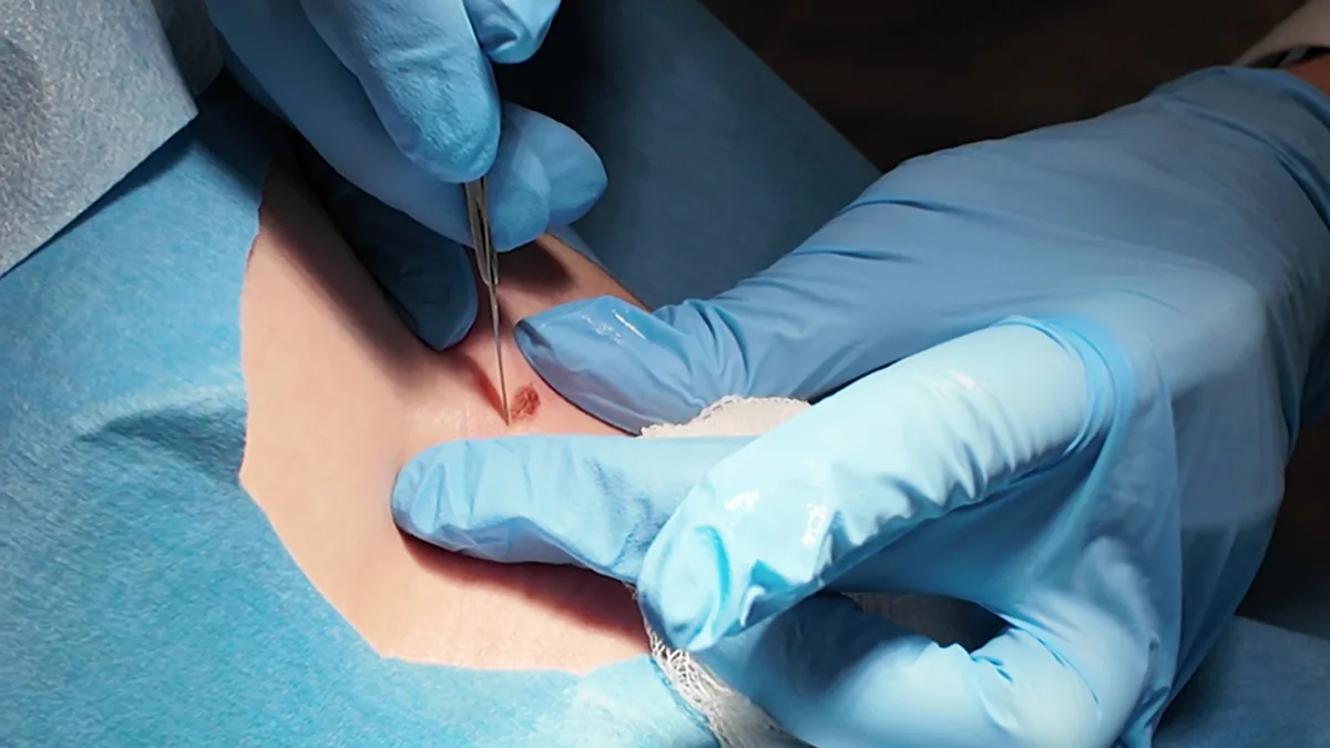 Minor Surgeries